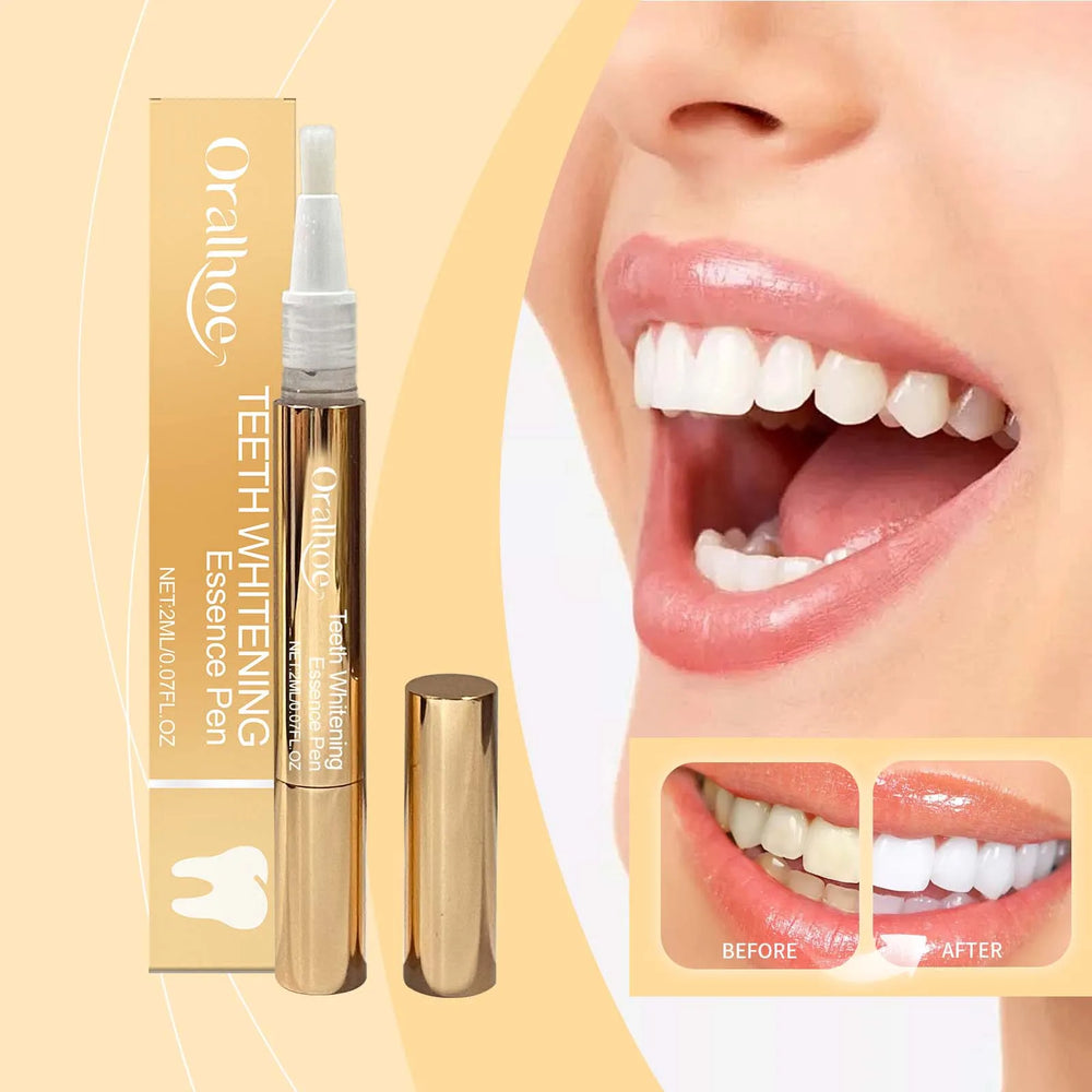 Teeth Whitening Essence Pen Remove Plaque and Tartar Clean Dental Oral Care Prevent Teeth from Rotting and Keep Fresh Breath